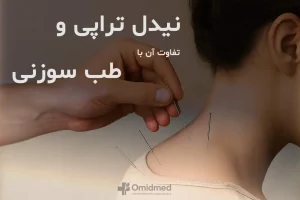 نیدل تراپی و طب سوزنی